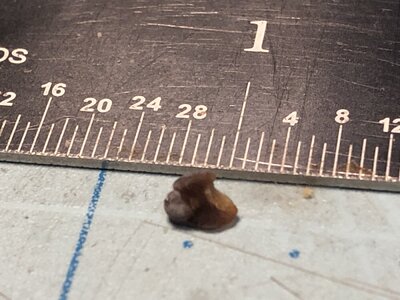 Kidney Stone 2-23-23.jpg