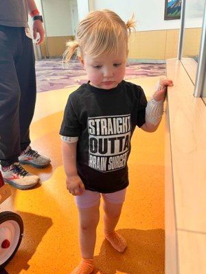 Abi after brain surgery 18 Jun 2022 small.jpg